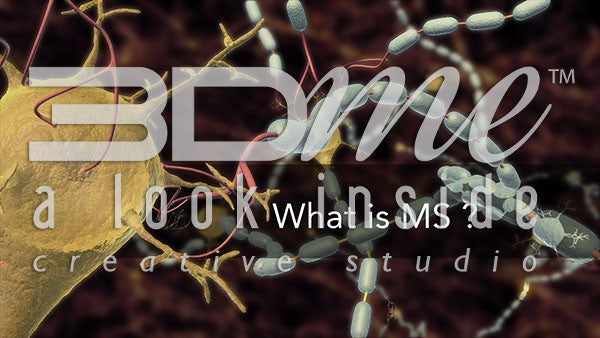 What is MS?