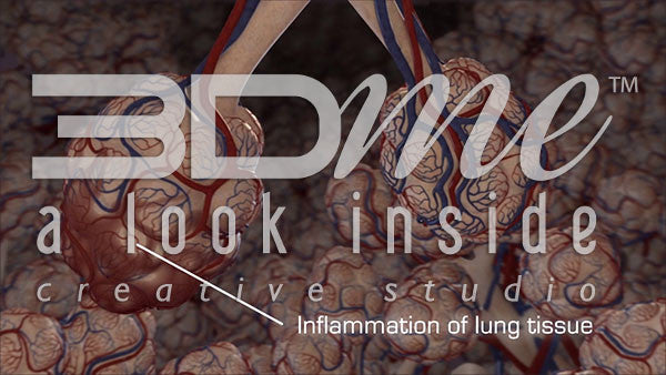 What is the extrinsic cause in Lobar Pneumonia?