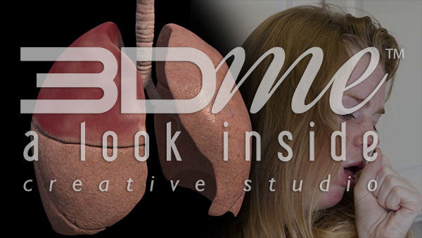 What are the symptoms of Lobar Pneumonia that affect the lung?