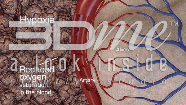 What is the definition of hypoxia?