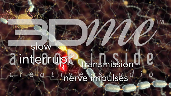 What happens inside the body of someone with MS?