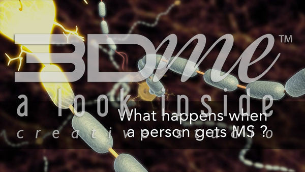 What happens when a person gets MS?
