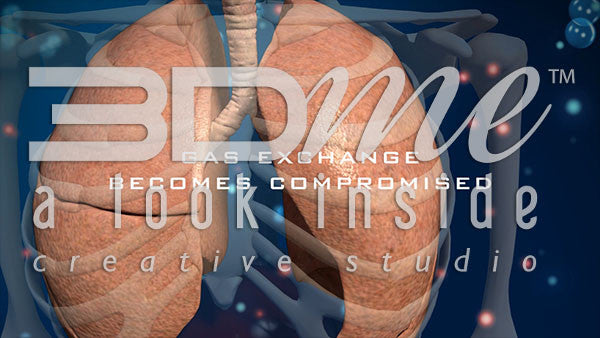 What is the physioloical process that leads to compromised gas exchange in lung disease?