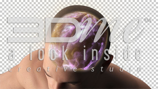 Brain Rotate Noise 1