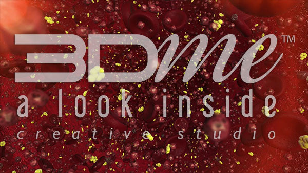 Diabetic Ketoacidosis