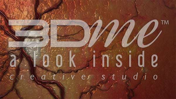 Diabetic retinopathy retina