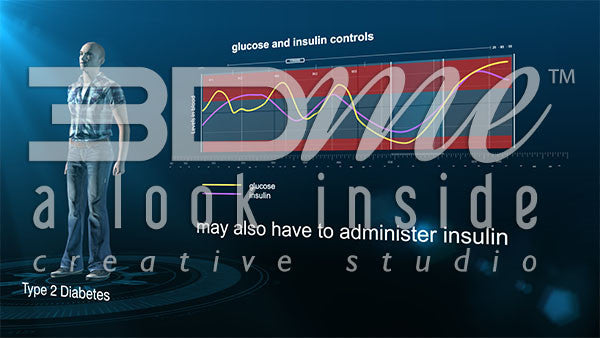 Graph glucose insulin administration