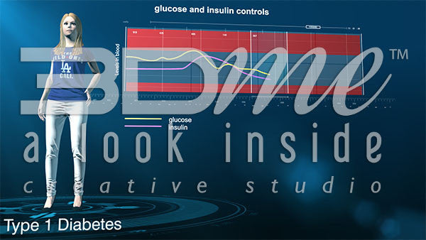 Graph glucose insulin type I diabetes