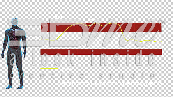 Graph high BGL levels 4