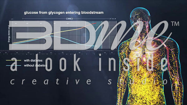 Graph: Hyperglycemia