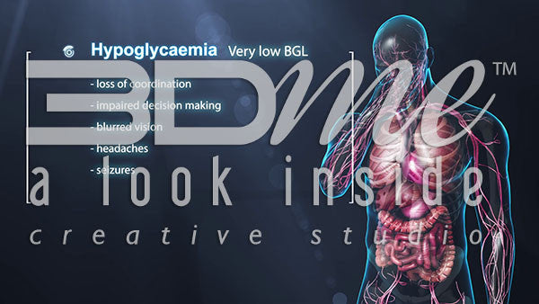 Graphic Listing - Hypoglycaemia Symptoms
