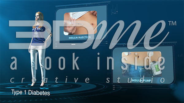 Graphics insulin intake