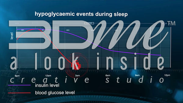 How is sleep disrupted by hypoglycaemia?