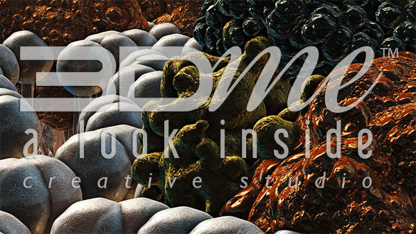 Insulin Resistance 11