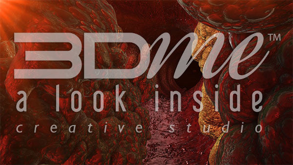 Large blood vessel fatty plaques 2