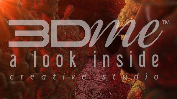 Large blood vessel fatty plaques 3 (DOF)