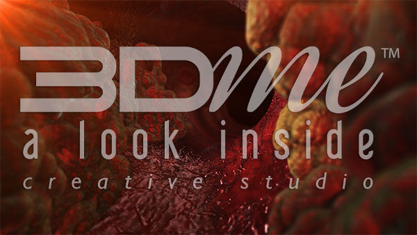 Large blood vessel fatty plaques 4 (DOF)