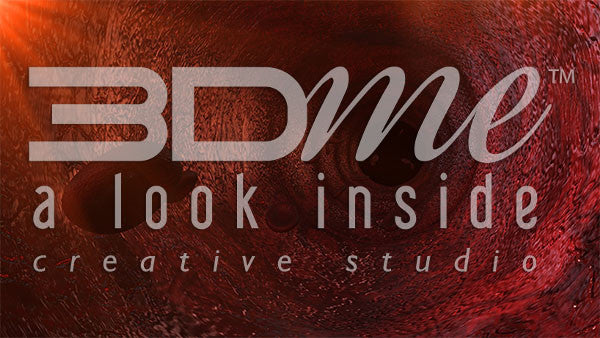 Large blood vessel macrovascular