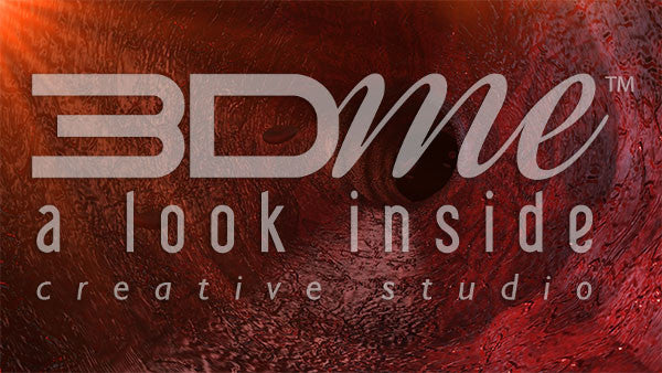 Large blood vessel macrovascular stiff