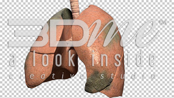 Lungs Pan Spinning Damage 2