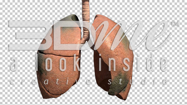 Lungs Pan Spinning Damage 3