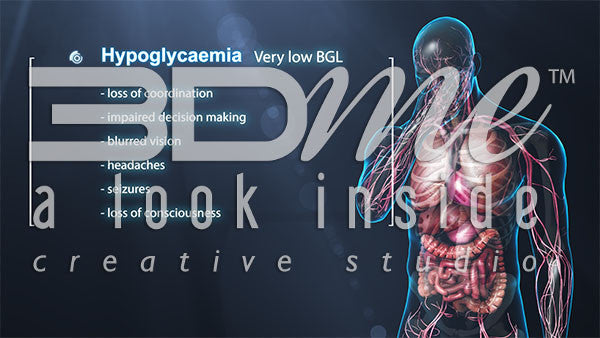Hypoglycemia (with male)