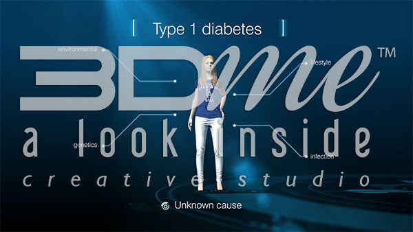 Type I Diabetes - Causes