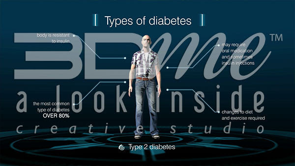 What are the causes of different kinds of diabetes?