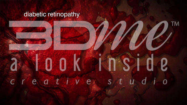 what are the main treatments for diabetic retinopathy?