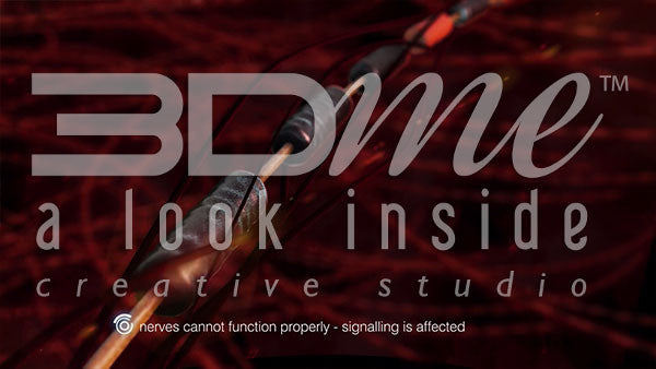 What is Diabetic Neuropathy?