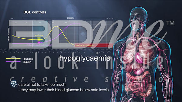 What is Hypoglycaemia?