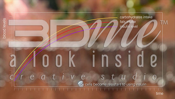 What are the causes of type 2 diabetes?