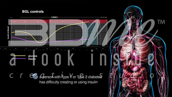 What is the link between diabetes and blood glucose levels?