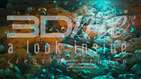 What is the cause of type 1 diabetes?