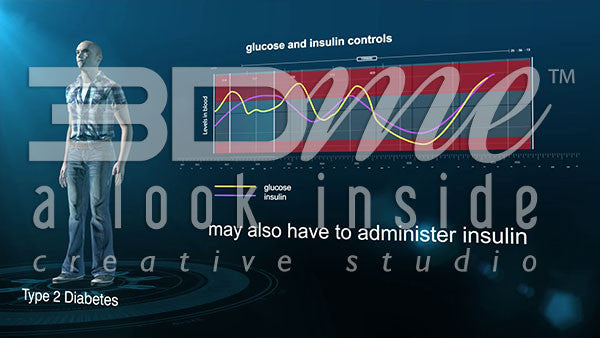 when would a type 2 diabetic need to start injecting insulin?