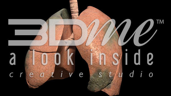 Lungs Pan Spinning Damage 2