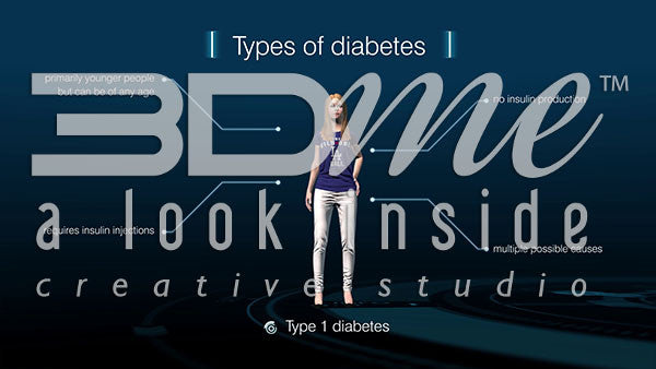 Type I Diabetes