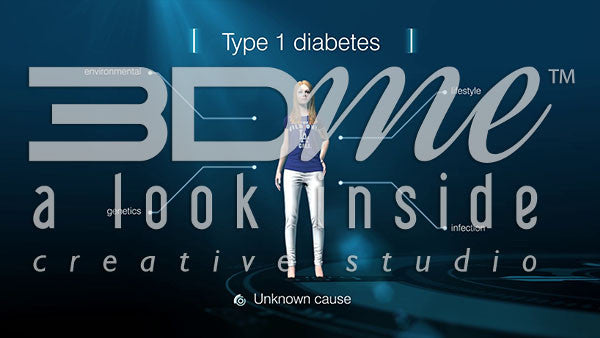 Type I Diabetes - Causes