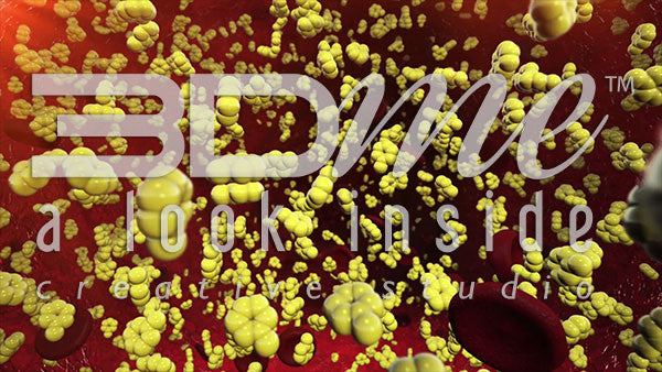 Glucose Accumulation