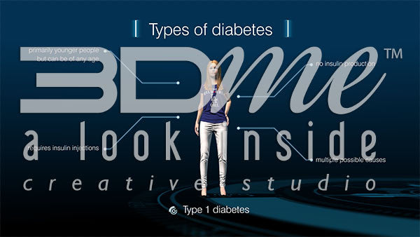 Graphic - Diabetes Types 2
