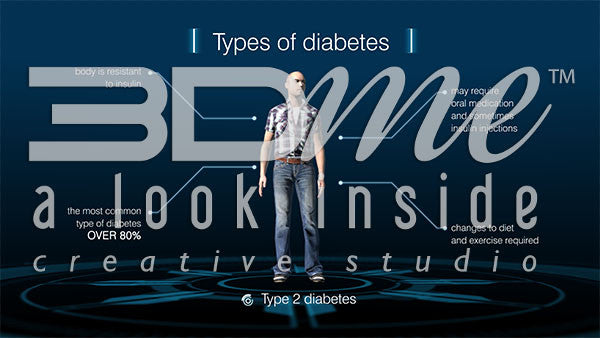 Graphic - Diabetes Types 3