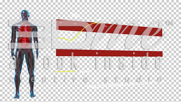 Graph high BGL levels 2