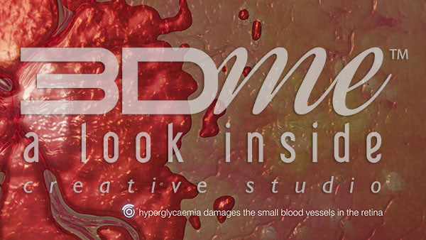 Eye Damage - Hyperglycaemia (with words)