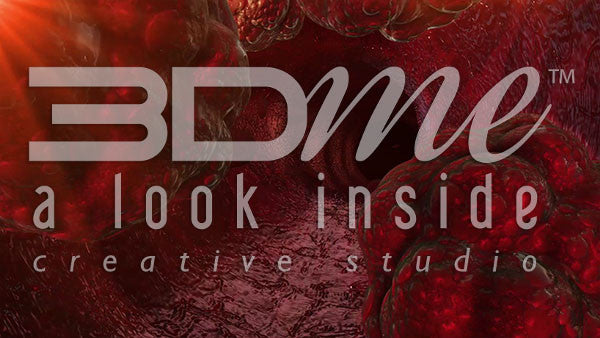 Large Blood Vessel Fatty Plaques