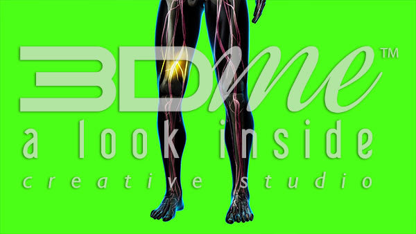 Legs - Damaged Blood Vessels (greenscreen)