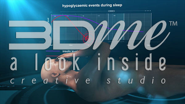 Graph and human: Hypoglycaemic events